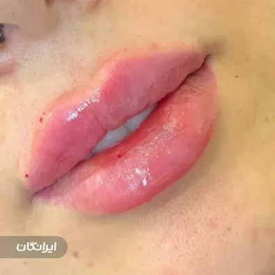 کلینیک مراقبت پوست مو زیبایی الیزه سرخ