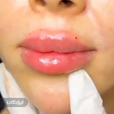 کلینیک مراقبت پوست مو زیبایی الیزه سرخ