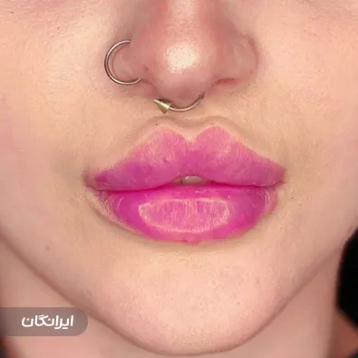 کلینیک زیبایی راد