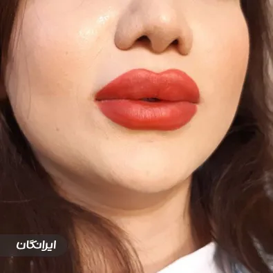 کلینیک زیبایی راد