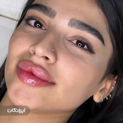 کلینیک زیبایی الوا