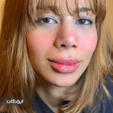 کلینیک زیبایی نایس