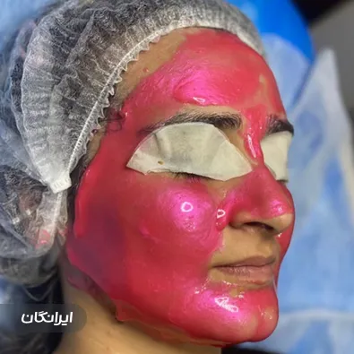 کلینیک زیبایی رابو استیک