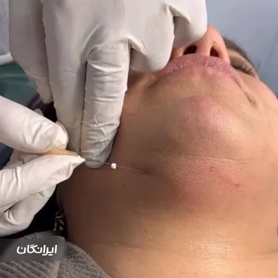 کلینیک زیبایی آبان