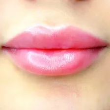 کلینیک زیبایی الگانت