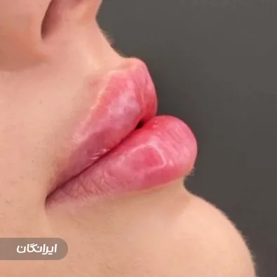 کلینیک زیبایی الگانت