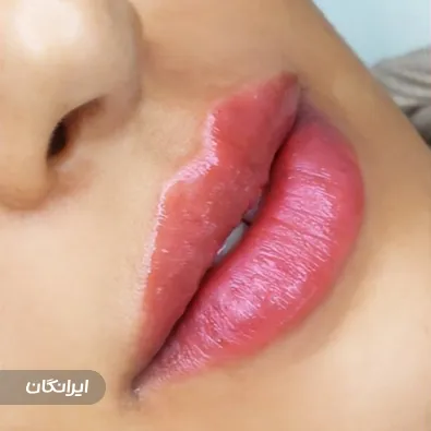 کلینیک زیبایی الگانت