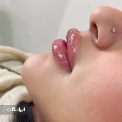 کلینیک زیبایی درمیس