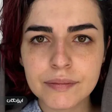 کلینیک زیبایی دکتر فرشته جلال پور