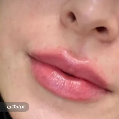 کلینیک زیبایی مهرویان