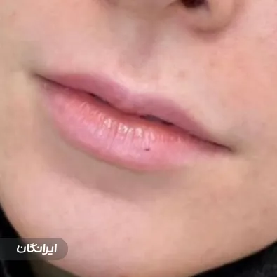 کلینیک زیبایی مهرویان