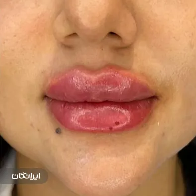 کلینیک زیبایی مهرویان