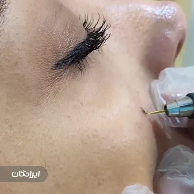 کلینیک زیبایی دکتر آذرسادات عفت نژاد