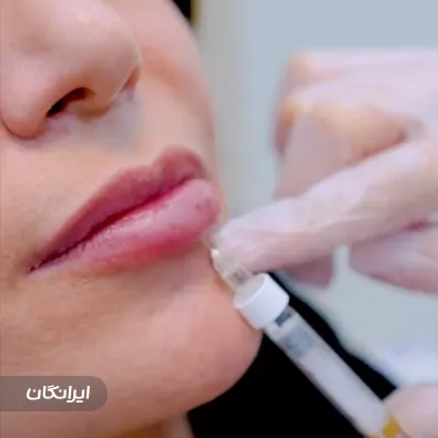 دکتر آنوش شفیعی