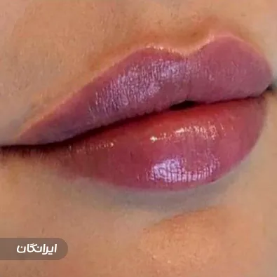 کلینیک زیبایی دکتر کریمی