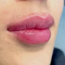 کلینیک زیبایی الیمو