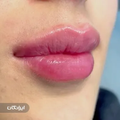 کلینیک زیبایی الیمو