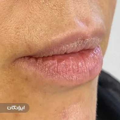 کلینیک زیبایی الیمو