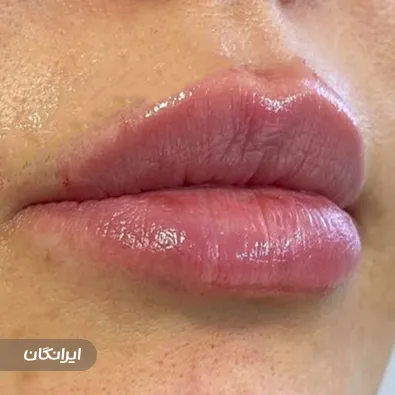 کلینیک زیبایی الیمو