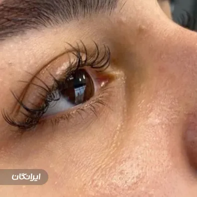 کلینیک زیبایی دکتر نرگس خالقیان