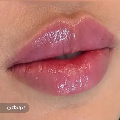 کلینیک زیبایی دکتر نرگس خالقیان