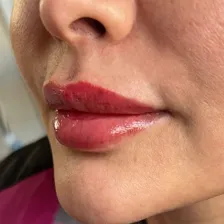 کلینیک زیبایی دکتر نرگس شایسته فرد