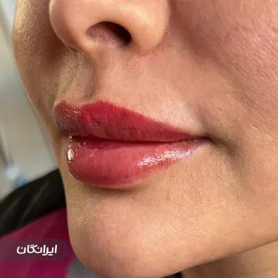 کلینیک زیبایی دکتر نرگس شایسته فرد