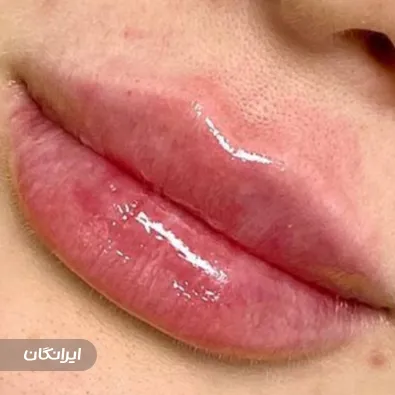 کلینیک زیبایی سینوهه