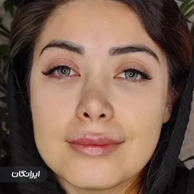 کلینیک زیبایی دکتر مینا رضایت