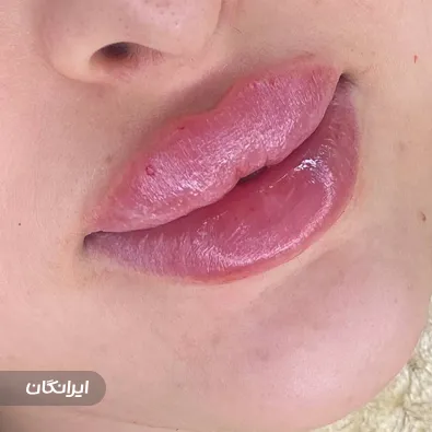 کلینیک زیبایی باریندخت