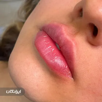 کلینیک زیبایی دکتر مهری ابریشم چی