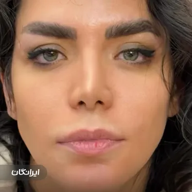 کلینیک زیبایی دکتر علی خاتمی