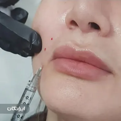 کلینیک زیبایی رز آبی