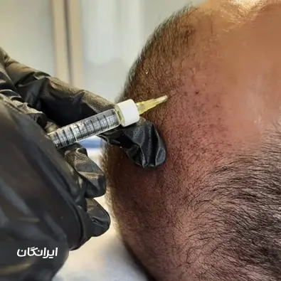 کلینیک زیبایی رز آبی