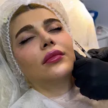 کلینیک زیبایی هلن