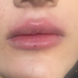 کلینیک زیبایی دکتر مینا منتصری