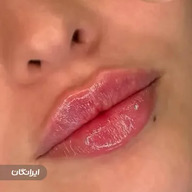 کلینیک زیبایی دکتر ندا پژوهی