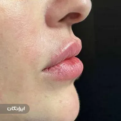 کلینیک زیبایی نیلو