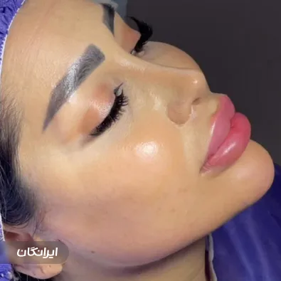 کلینیک زیبایی شارمین