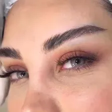 کلینیک زیبایی ایران مهر