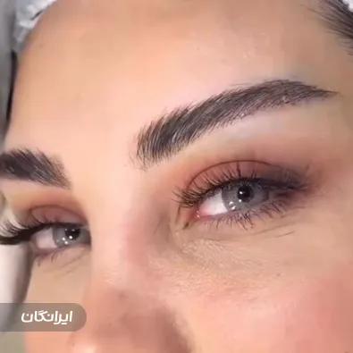 کلینیک زیبایی ایران مهر