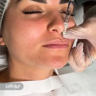 مجموعه لاغری و زیبایی آرزو نوری