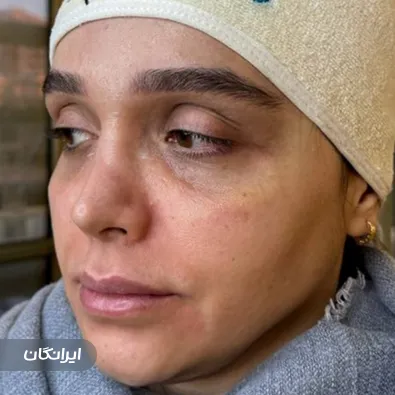 مجموعه لاغری و زیبایی آرزو نوری