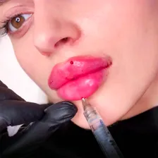 کلینیک زیبایی روژا