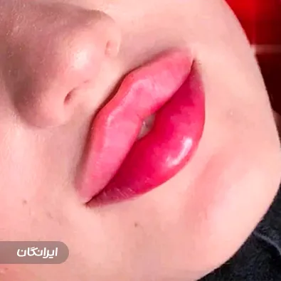 کلینیک زیبایی روژا