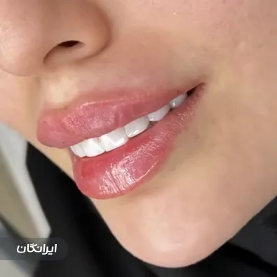 کلینیک زیبایی مهراز