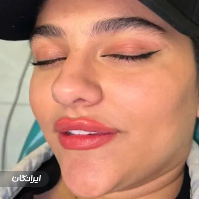 کلینیک زیبایی دکتر لیلا صفی صمغ آبادی