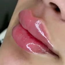 کلینیک زیبایی دکتر لیلا صفی صمغ آبادی