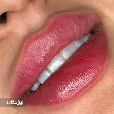 کلینیک زیبایی دکتر جهانبخش محبان