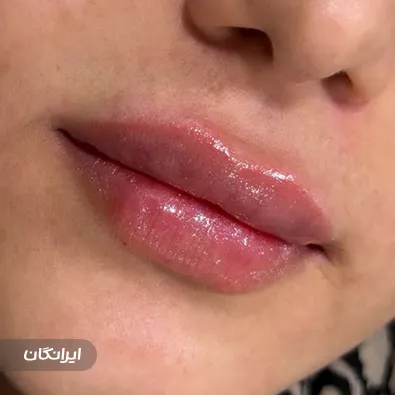 کلینیک زیبایی اورانوس